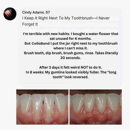 CollaBond